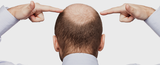 Saç Bakımı Web Sitesi Şablonu